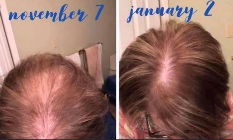 Shampoo & Conditioner Set